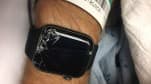 Nhờ đeo Apple Watch, cụ ông tại Mỹ may mắn được cứu sống khi bị chấn thương sọ não do ngã xe