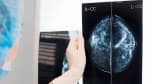 AI 'trợ lực' của bác sĩ trong phát hiện ung thư